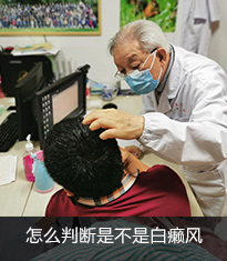 白癜风症状